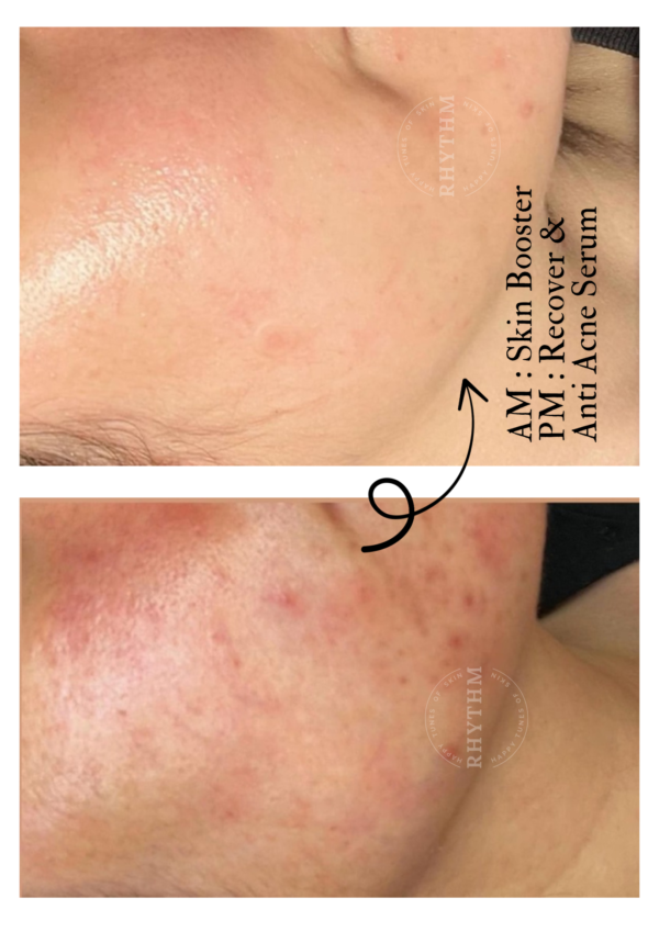 8A898950-649E-4A04-A8F1-57935DF448D3