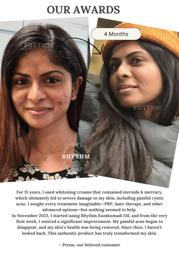 EBA45CD8-E49C-4665-85E2-80DB16B2E248